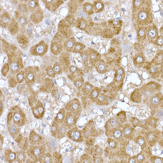 MT-ND6 Rabbit polyclonal antibody