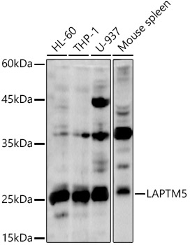 LAPTM5 Rabbit polyclonal antibody