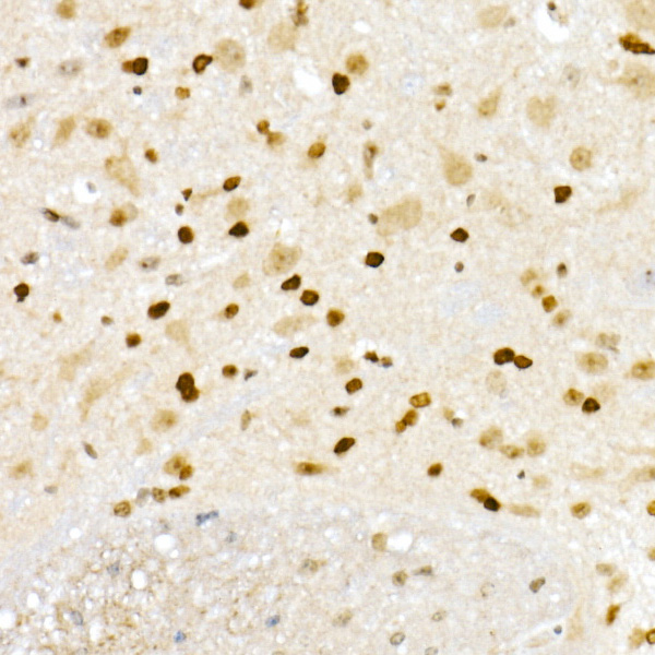 XRCC2 Rabbit polyclonal antibody