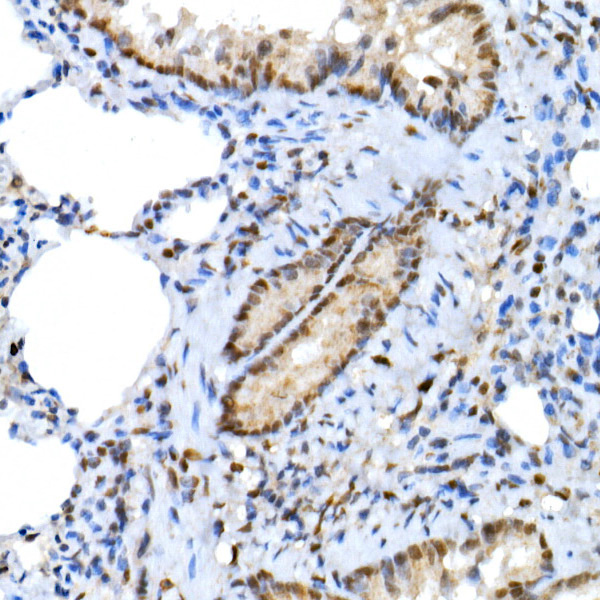 XRCC2 Rabbit polyclonal antibody