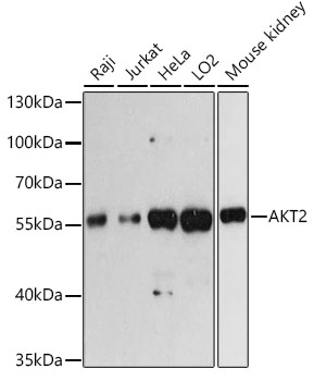 AKT2 Rabbit polyclonal antibody
