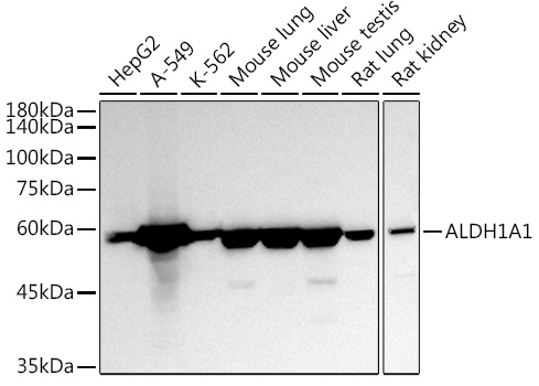 ALDH1A1 Rabbit polyclonal antibody