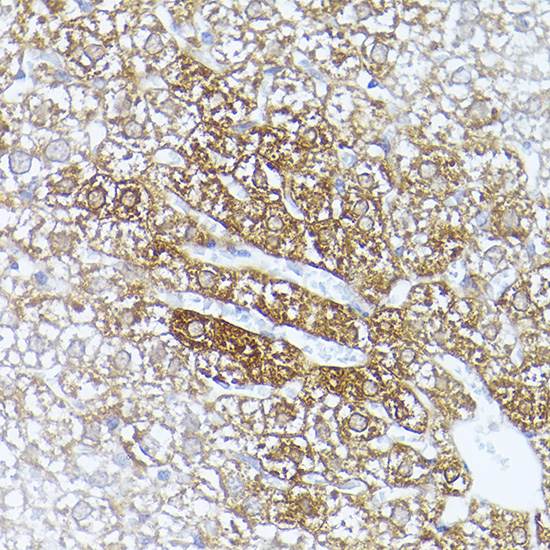 ALDH1A1 Rabbit polyclonal antibody
