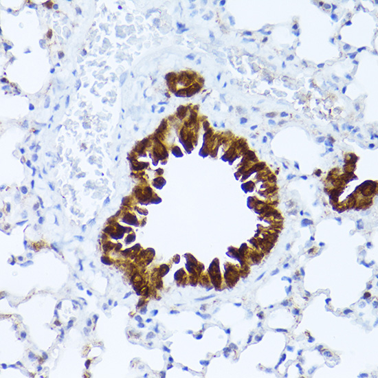 ALDH1A1 Rabbit polyclonal antibody