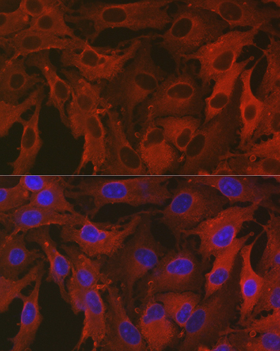 ALDH1A1 Rabbit polyclonal antibody