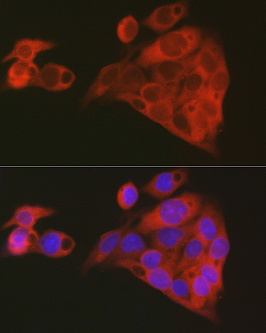 ALDH1A1 Rabbit polyclonal antibody