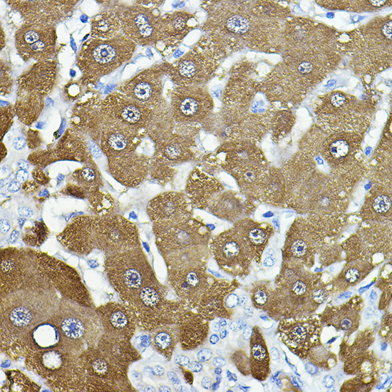 NNMT Rabbit polyclonal antibody
