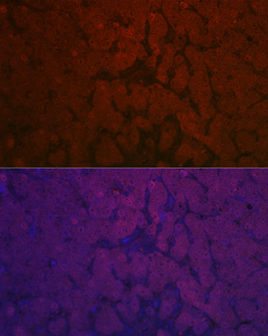 NNMT Rabbit polyclonal antibody