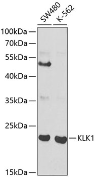 KLK1 Rabbit polyclonal antibody