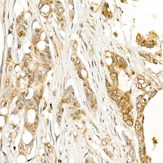 KLK1 Rabbit polyclonal antibody