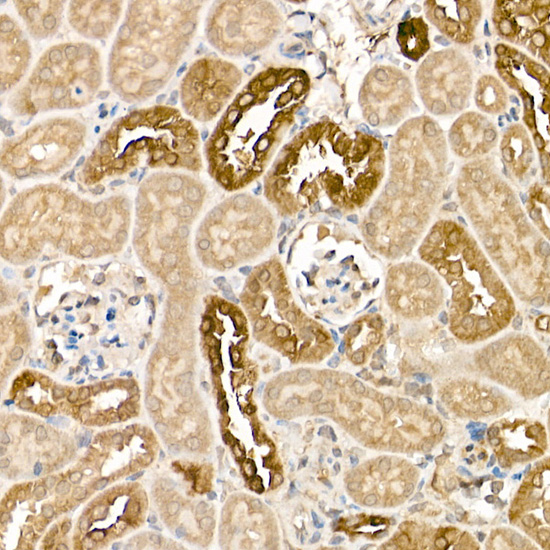 KLK1 Rabbit polyclonal antibody