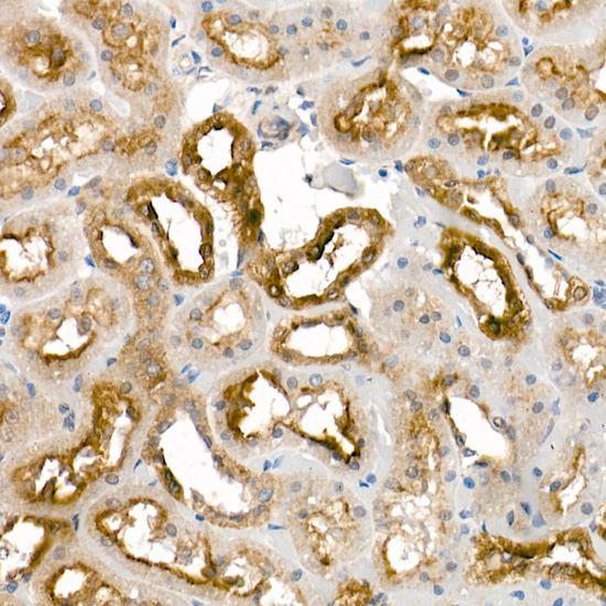 KLK1 Rabbit polyclonal antibody