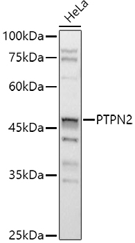 [KO Validated] PTPN2 Rabbit polyclonal antibody
