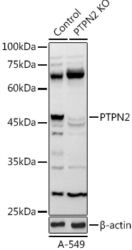 [KO Validated] PTPN2 Rabbit polyclonal antibody