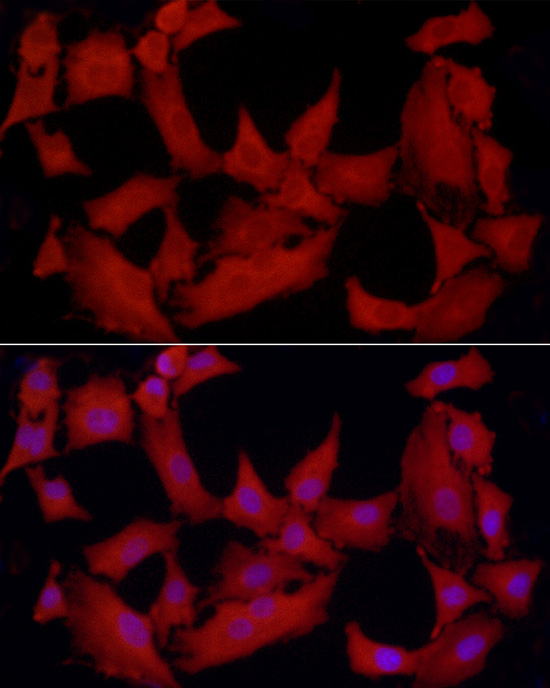 [KO Validated] PTPN2 Rabbit polyclonal antibody
