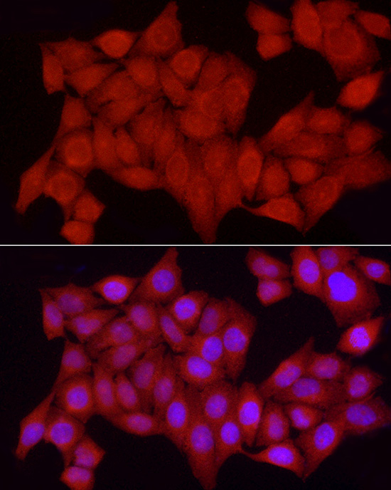 [KO Validated] PTPN2 Rabbit polyclonal antibody