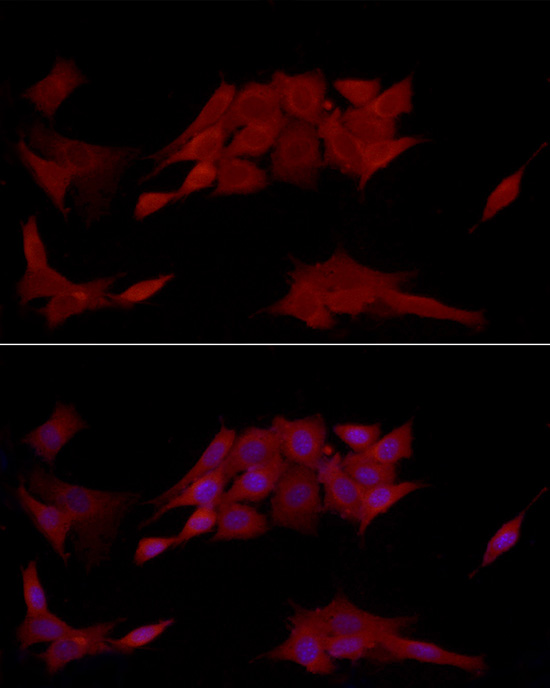 [KO Validated] PTPN2 Rabbit polyclonal antibody