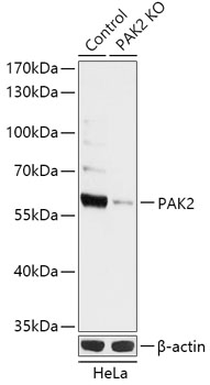 [KO Validated] PAK2 Rabbit polyclonal antibody
