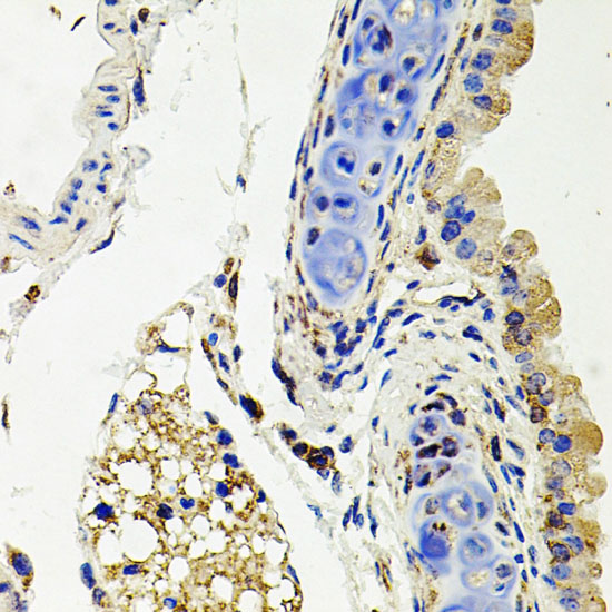 SDC2 Rabbit polyclonal antibody