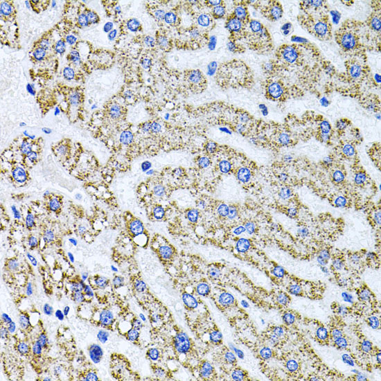 SDC2 Rabbit polyclonal antibody