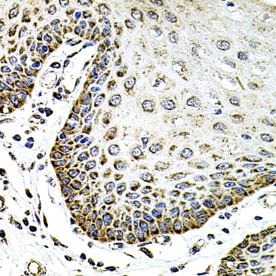 SDC2 Rabbit polyclonal antibody