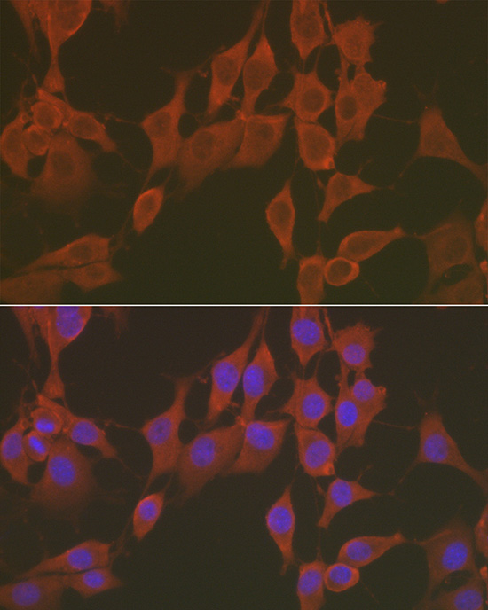 FNDC5 Rabbit polyclonal antibody