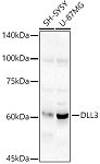 Western blot - DLL3 Rabbit pAb (A18108)