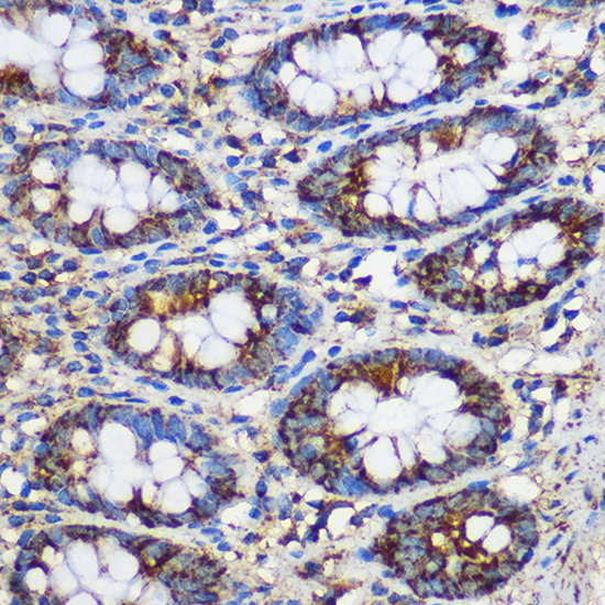 TEX101 Rabbit polyclonal antibody