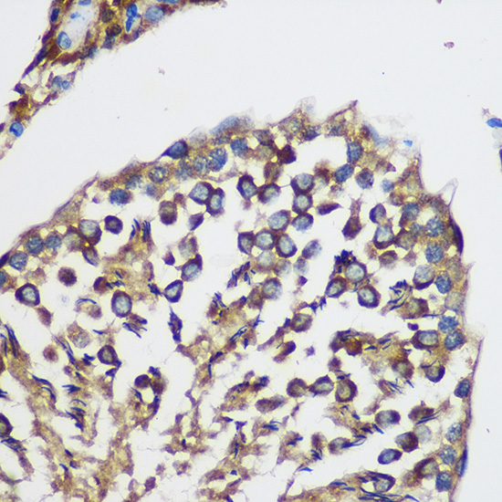 TEX101 Rabbit polyclonal antibody