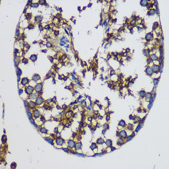 TEX101 Rabbit polyclonal antibody