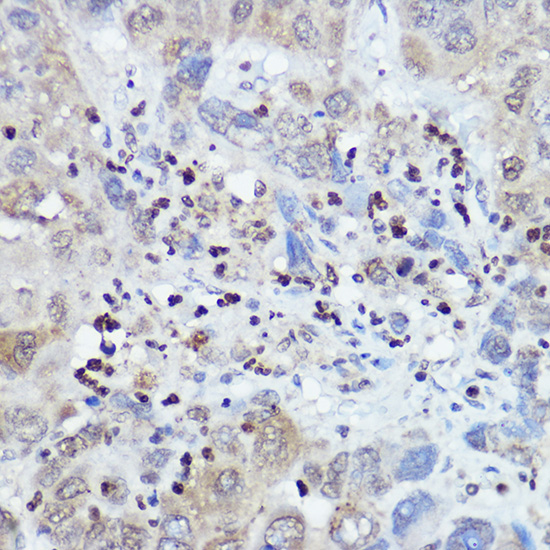 FANCC Rabbit polyclonal antibody
