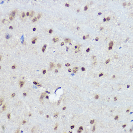 FANCC Rabbit polyclonal antibody