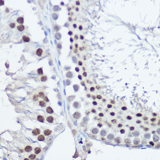 FANCC Rabbit polyclonal antibody