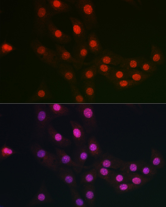 FANCC Rabbit polyclonal antibody