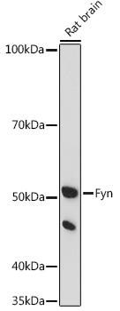 Fyn Rabbit polyclonal antibody