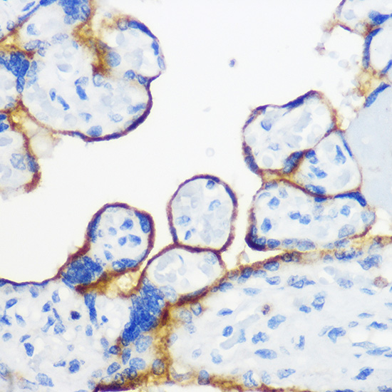 Fyn Rabbit polyclonal antibody