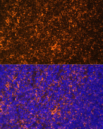 Fyn Rabbit polyclonal antibody