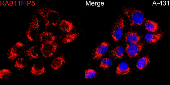 RAB11FIP5 Rabbit polyclonal antibody