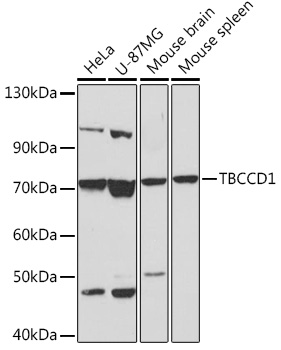 TBCCD1 Rabbit polyclonal antibody
