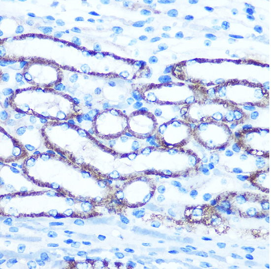 TBCCD1 Rabbit polyclonal antibody