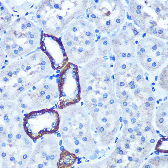 TBCCD1 Rabbit polyclonal antibody