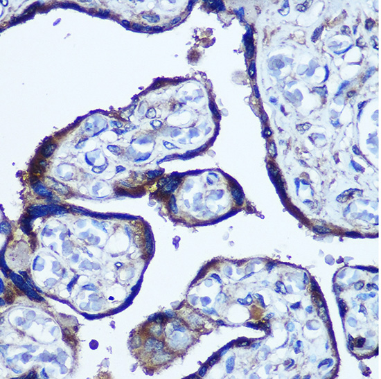 TBCCD1 Rabbit polyclonal antibody