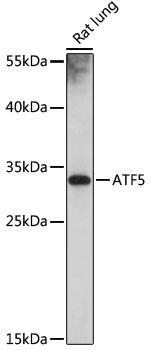 ATF5 Rabbit polyclonal antibody