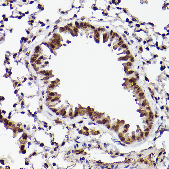 ATF5 Rabbit polyclonal antibody