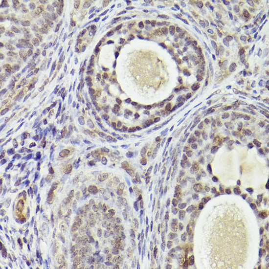 ATF5 Rabbit polyclonal antibody