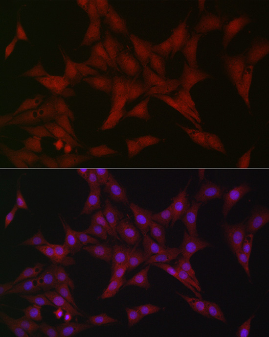 ATF5 Rabbit polyclonal antibody