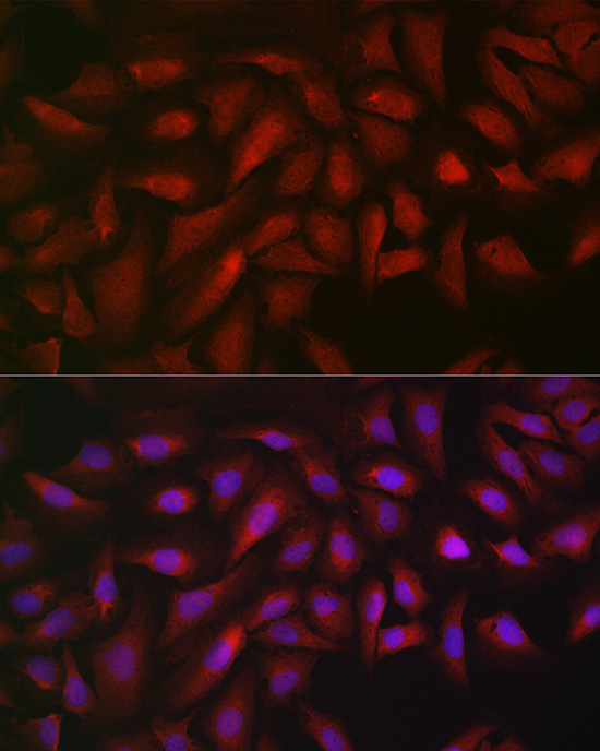 ATF5 Rabbit polyclonal antibody