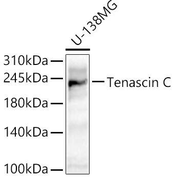 Tenascin C Rabbit polyclonal antibody