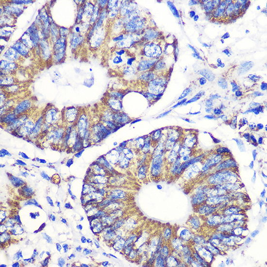 Tenascin C Rabbit polyclonal antibody