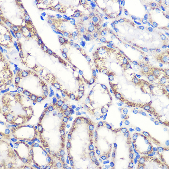 Tenascin C Rabbit polyclonal antibody